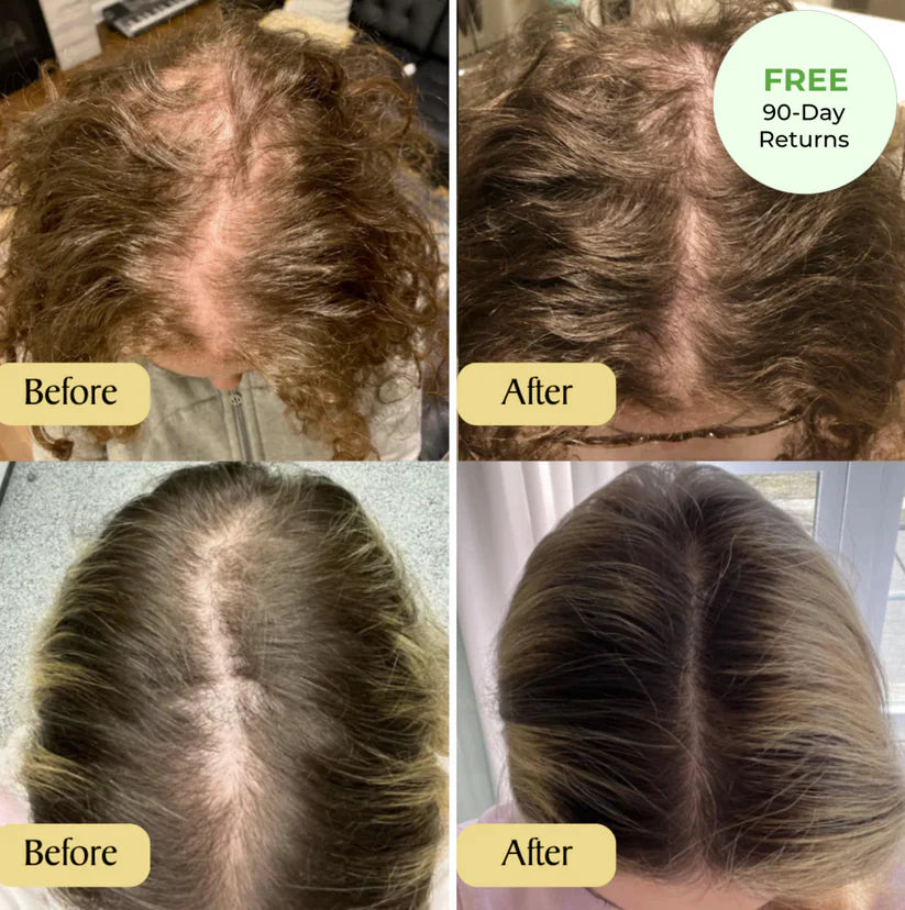 Vegan Hair Growth Oil
